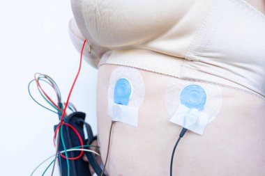 Holter izleme için kadın vücudundaki sensörler, günlük elektrokardiyogram, kan basıncı, kardiyak muayene, kalp hastalıklarının tedavisi için Holter monitörü olan kadın.