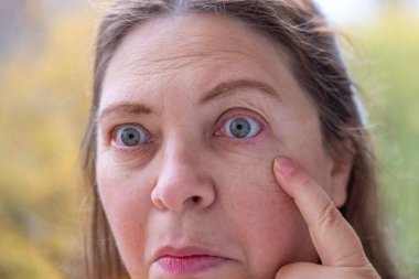 Olgun kadın yüzü kadın 50-55 yaşlarında görünüyor, göz çevresindeki kırışıklıkları inceliyor, göz kenarındaki jestleri, zihinsel yorgunluğu, yaşla ilgili değişiklikleri, hafıza kaybı, estetik bakım, yaşlanma önleyici prosedürleri