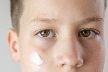Ergenlik çağında yüzlerine sivilce kremi süren, hormonal sivilcelerle uğraşan, sağlıklı kişisel bakım rutinleri geliştiren, tipik ergenlik değişimleri ve duygusal zorluklarla yüzleşen bir çocuk.