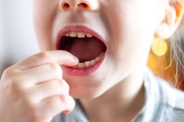 Yakın plan el çocuğu, küçük çocuk, sarışın kız 6 yaşında ağzı yeni sivri dişli parmak, bebek dişi titremeleri, çocuk sağlığı, pediatrik dişçilik, tıkanıklığın diş düzeltmesi