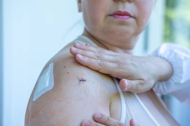Doktor, cerrahi yarayı, kadın hastayı, omuz yaralanmasını, steril aletleri, iyileşme sürecini, klinik hijyeni, ameliyat sonrası bakımı, tıbbi profesyonel temizlik prosedürünü, 