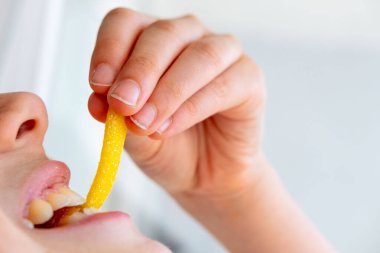 Yakın plan acı çeken, başı ağrılı, çocuk migreni baş ağrısı ve büyüme stresiyle boğuşan, acı çeken, yüzü gergin, ergenlik belirtileri gösteren genç bir çocuk. 