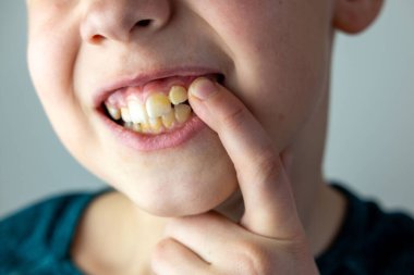 Çocuk denizde neşeyle yüzüyor, yaz tatilinin tadını çıkarırken su güvenliği becerilerini öğreniyor, çocuk deniz dalgalarında oynuyor, kaygısız ve mutlu, ebeveynler güvenliği ve boğulma riskini göze alıyor. 