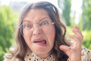 Kadın, el ele köprücük kemikleri ve dcolletage, cilt kırışıklıkları, çiller ve benler, yaşla ilgili deri değişiklikleri, estetik enjeksiyon kozmetolojisi, bakım yaşlanmayı önleyici prosedürler. 