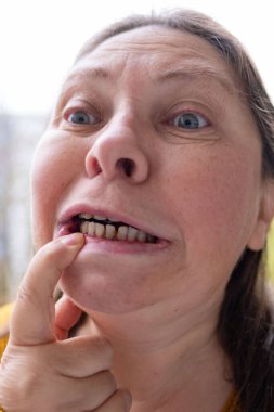 Kadın, el ele köprücük kemikleri ve dcolletage, cilt kırışıklıkları, çiller ve benler, yaşla ilgili deri değişiklikleri, estetik enjeksiyon kozmetolojisi, bakım yaşlanmayı önleyici prosedürler. 