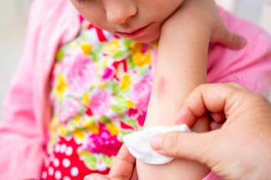 Genç balerinler geri döndü, skolyoz hastası küçük bir kız çocuğu 5 yaşında eğri büğrü duruyor, omurga deformasyonu eğri, ortopedik durum, tıbbi yardıma ihtiyacı var, pediatrik duruş 