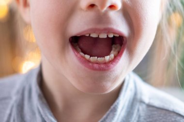 Genç balerinler geri döndü, skolyoz hastası küçük bir kız çocuğu 5 yaşında eğri büğrü duruyor, omurga deformasyonu eğri, ortopedik durum, tıbbi yardıma ihtiyacı var, pediatrik duruş 