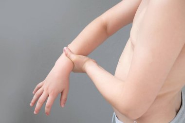 Yaralı kol, tıbbi işlemden sonra erkek el donörü derisinde yakın plan morarma, dirsek bölgesinde kan alma, sağlık kontrolü, kan testi prosedürü, çocuk güvenliği, tıbbi durum