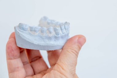 İki hafif diş macunu kalıbı, ortodontik modeller üst ve alt çene, diş telleri veya takma dişler için hazırlık, diş kalıpları, dişçilik konsepti