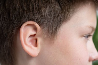 Makro çocukları kulaklarına yakın çekim, çocuk dinlemesi, insan yüzü detayı, işitme testi, koklear implant, assistive dinleme cihazı, çınlama veya vızıldama hissi, işitsel bozukluk, tıbbi durum  