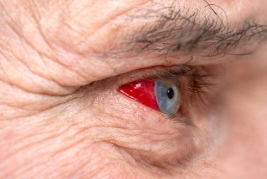 Olgun yaşlı bir adam yatakta huzur içinde uyuyor, sağlıklı gece uykusu ve önemli kaliteli uyku, dinlenme ihtiyacı, denge ve uykusuzlukla ilgili sorunlardan korunma bozuklukları. 