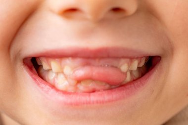 Komik, komik, dişsiz bir kız. Dilini dişlerindeki boşluğa sokuyor. Çocukluğu diş perisini bekleyerek geçiriyor.