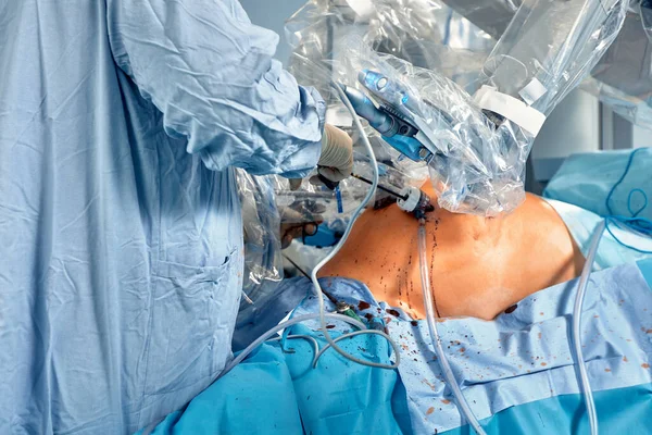 Hastanede Asgari Invazif Robot Cerrahi Sistemi Var Robot Teknolojisi Ekipmanları — Stok fotoğraf