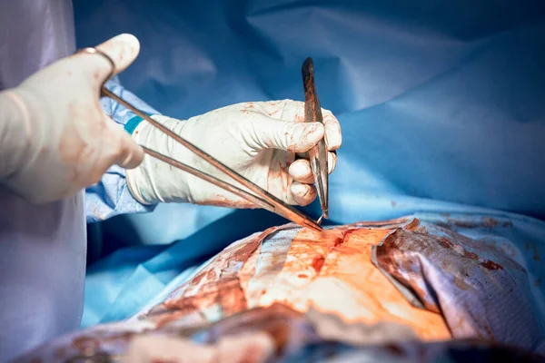 手术结束时 外科医生给病人缝好了皮肤 有选择的重点 医生们手拿无菌手套 用针头和线在人的皮肤上缝上伤口 — 图库照片