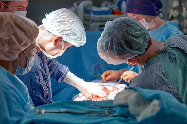 手术期间手术室里的外科医生的脸 现代医学 复杂手术中的医务工作者 现代医学 — 图库照片