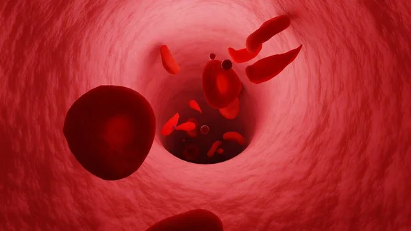 Vein tunnel. Sickle cells circulate in vein. Erythrocytes and platelets. Blood cells moving through a vein. 3D render.