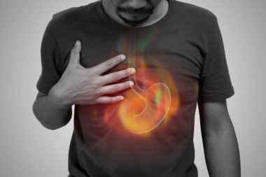 A man burning sensation in the of the middle chest because of acid reflux. Hot in middle chest caused by hyperacidity.