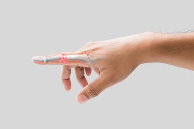 Bir adamın parmağı kırıktır..