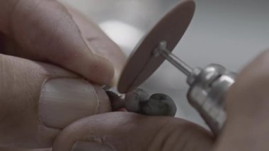 Dental Technician Rounds the Metal Substructure of Implant Prosthesis Teeth by Cutting It with a Milling Machine Footage.