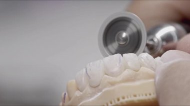 Sınırlı İmplant Zirkonyum Protezinin Milling Görüntülü Azaltılması ve Yuvarlanması.