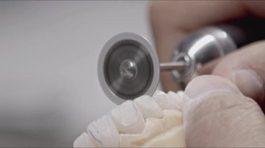 Diş Teknisyenleri Laboratuvar Görüntülerinde Kalem ile İşaretlenmiş İmplant Protezi.