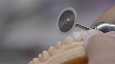 Diş Teknisyeni Şeklinde İmplant Diş Bölümü Görüntüsü.