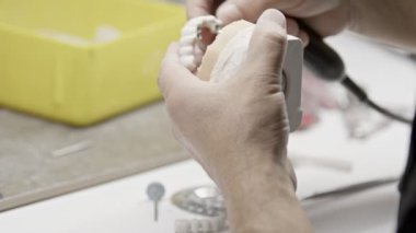 Diş teknisyeni diş implantının tüm çene porselenlerini kontrol etti.
