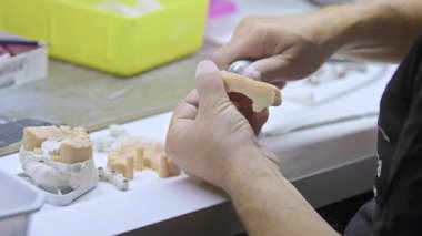 Laboratuvar görüntülerinde porselen diş implantı..