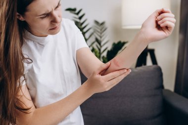 Kanepede oturan sağlıksız, üzgün, genç esmer kadın cilt sorunları yaşıyor, evde dayanılmaz acılar çekiyor. Yaralı deri yanıkları. Dermatoloji, tıbbi tedavi konseptiyle cilt sorunundan kaynaklanan güzellik bakımı