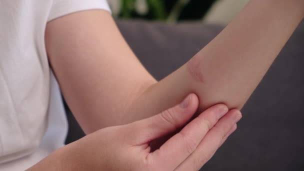 Närbild Ohälsosam Ung Kvinna Har Hudproblem Känner Outhärdlig Smärta Och — Stockvideo