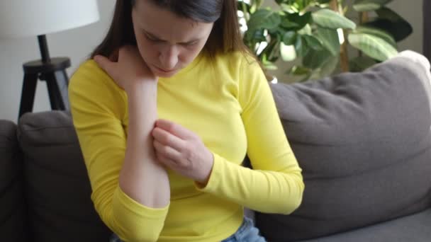 Conceito Dermatologia Mulher Jovem Infeliz Com Reação Alérgica Atópica Picadas — Vídeo de Stock