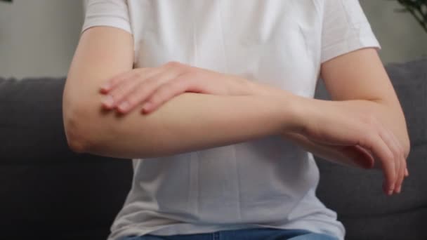 Close Mulher Caucasiana Jovem Com Reação Alérgica Atópica Picadas Insetos — Vídeo de Stock