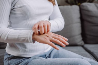 Close up of unhealthy young woman sitting on couch suffering from itching on her skin and scratching an itchy place. Allergic reaction to insect bites, dermatitis. Health care concept. Allergy rash clipart