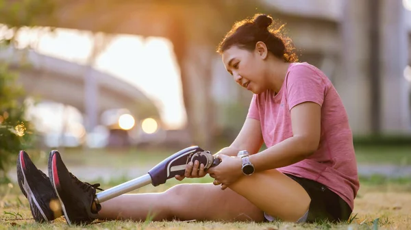 stock image Athlete with prosthetic leg doing warm up exercise on park. Woman wearing prosthetic equipment  for jogging. Female with prosthesis of leg