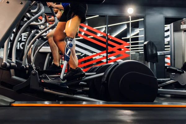 Αθλητική Γυναίκα Τεχνητό Πόδι Που Τρέχει Διάδρομο Γυμναστικής Γυναίκα Προσθετικό — Φωτογραφία Αρχείου