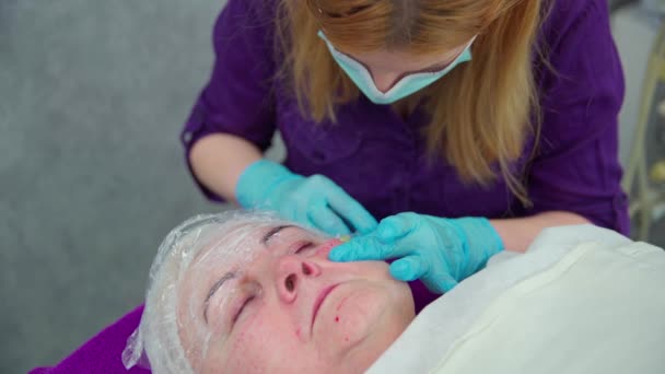 Cliente Salón Belleza Está Experimentando Tratamiento Mesoterapia Esteticista Realiza Múltiples — Vídeo de stock