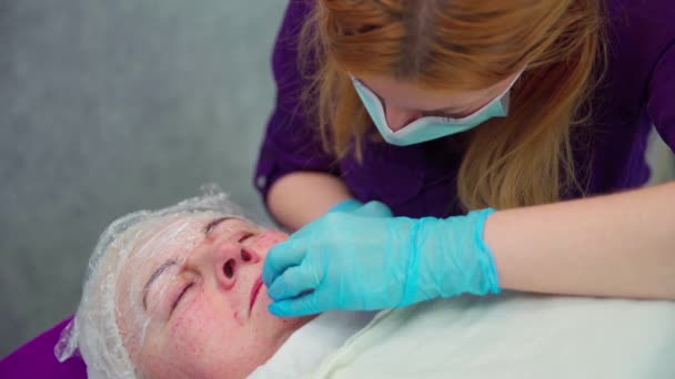 미용실의 서비스를 사용하여 여성의 얼굴에 클로즈업 그녀는 Mesotherapy 치료를 받고있다 — 비디오