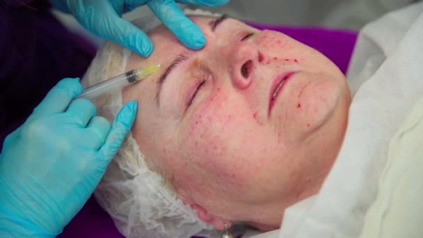 高齢の女性は美容室で顔の手術をしている 化粧品学者は女性の額に一連のヒドゥーマチックなパンクを施しています 新鮮な血痕が見える — ストック動画