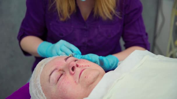 Primer Plano Cara Una Mujer Sometida Tratamiento Rejuvenecimiento Cosmetólogo Inyecta — Vídeos de Stock