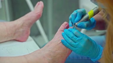 Kozmetik yatakta yatan bir kadının ayaklarının yakın çekimi. Kadın ayak hastalıkları uzmanından yardım alıyor. Ayaklarındaki deri buruşuk çünkü daha önce bir su banyosunda ıslanmışlardı..