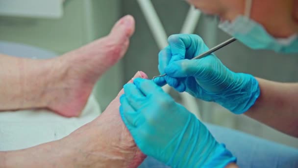 美容师们的密切合作 一位美容师在他的客户脚边工作 美容院的专家在脚趾甲周围去除角质层 — 图库视频影像