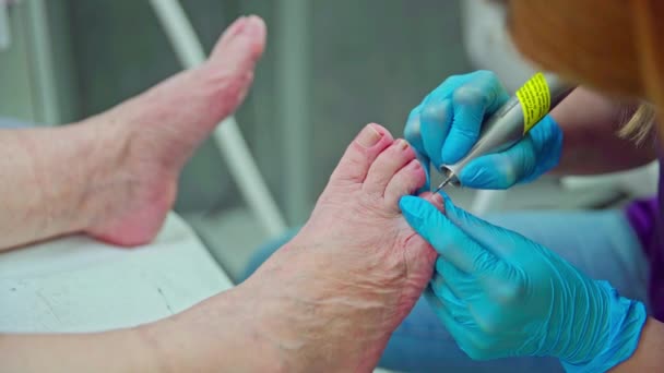 一个足科医生把他的客户的脚钉在钉子上 一个女人的小腿和脚的特写躺在一张化妆品床上 这位足科医生是带着一次性手套工作的 — 图库视频影像