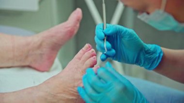 Sert tırnaklar profesyonel kozmetik tedaviler gerektirir. Bir kadın ayak hastalıkları uzmanının hizmetlerinden yararlanır. Bir profesyonelin ayak tırnaklarını tedavi etmesi.