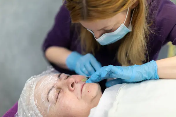 Needle marks can be seen on the face of an elderly woman. She is a patient of an aesthetic medicine clinic. A cosmetologist performs a needle mesotherapy treatment for the patient.