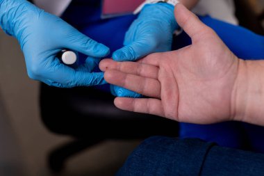 Kendini işine adamış bir sağlık çalışanı titizlikle hastanın eline önemli bir tıbbi test uygulamaya hazırlanıyor.