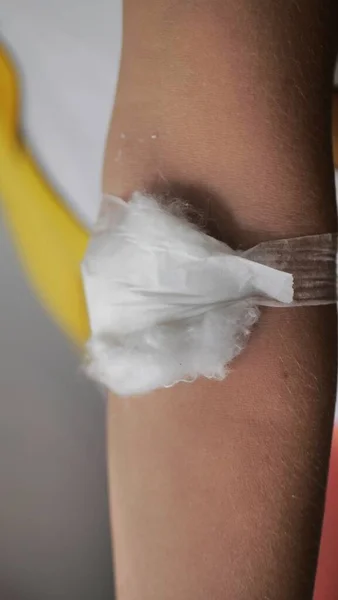 Egy Pamutgyapjúval Karján Kék Alapon Történő Injekció Vagy Vakcinázás Után — Stock Fotó