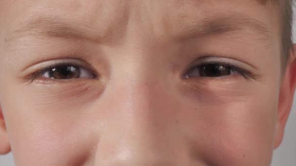 Detailní Záběr Chlapecké Tváře Dívá Objektivu Kamery Šilhá Blonďáku Zblízka — Stock video