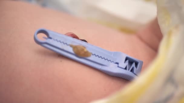 新生儿脐带的护理 — 图库视频影像