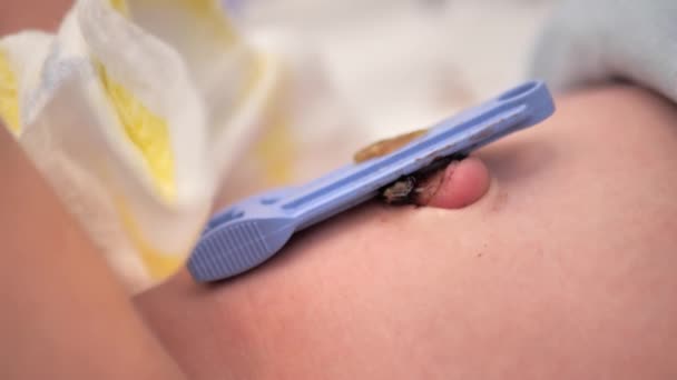 Care Newborns Umbilical Cord Umbilical Cord Babys Stomach — Stok video