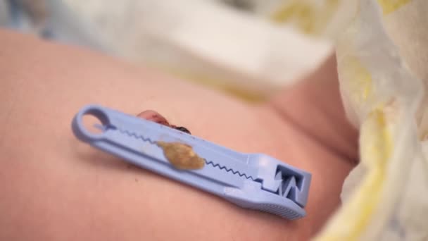 照顾新生儿脐带 婴儿肚子上的脐带 — 图库视频影像